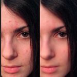 thumb_airbrush_skin_tutorial_retouch_0004-1525833